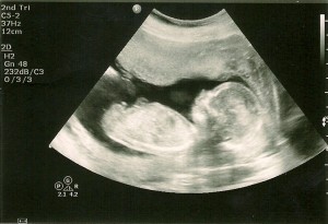 ultrasound baby boy 16 weeks